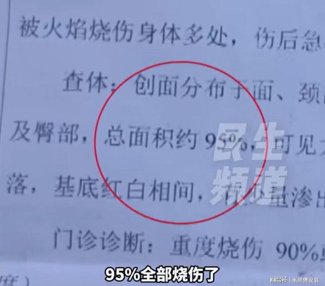 Kaiyun体育网站：女子烹饪时自制燃气罐爆炸面部重伤母亲泪洒：只她一个女儿。(图4)